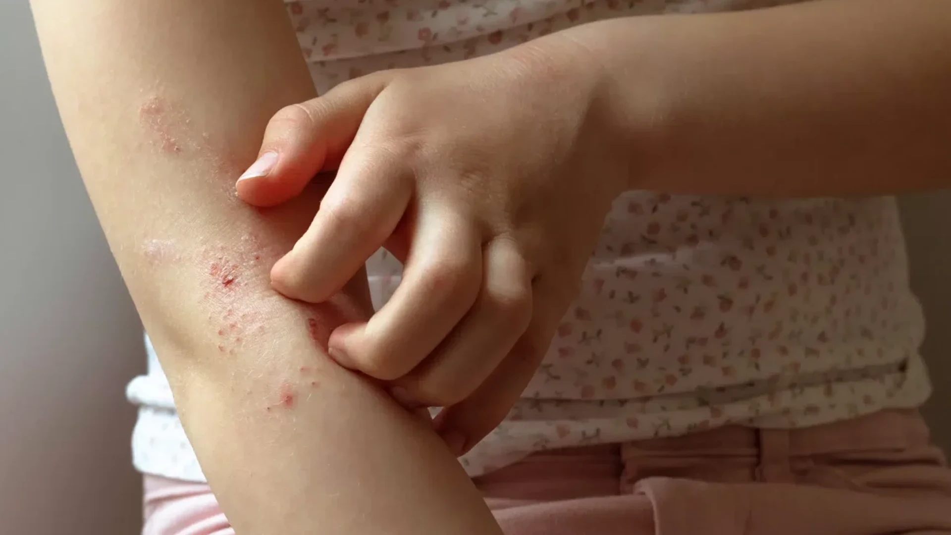 Inflamação silenciosa: o problema que você não vê, mas que pode comprometer sua saúde