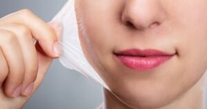 A Temporada da Renovação: Como os Peelings Químicos Transformam a Sua Pele