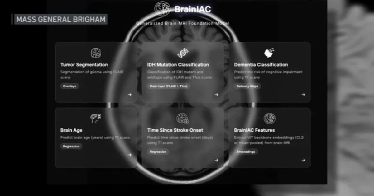BrainIAC: Nova IA desenvolvida em Massachusetts pode prever demência antes dos primeiros sintomas