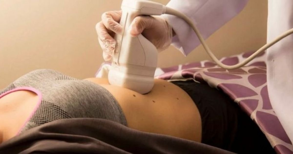 Tecnologia Lipossonix cresce em Massachusetts como alternativa não invasiva para gordura localizada