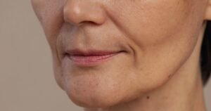 Efeito Derretimento Facial: Como a Tecnologia HIFU Devolve o Contorno do Rosto Sem Cirurgia