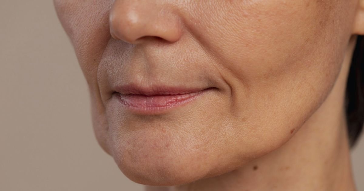 Efeito Derretimento Facial: Como a Tecnologia HIFU Devolve o Contorno do Rosto Sem Cirurgia