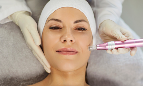 Microagulhamento com PDRN: Renovação Celular e Juventude da Pele