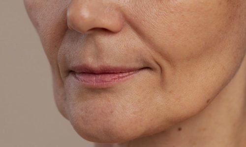 Efeito Derretimento Facial: Como a Tecnologia HIFU Devolve o Contorno do Rosto Sem Cirurgia