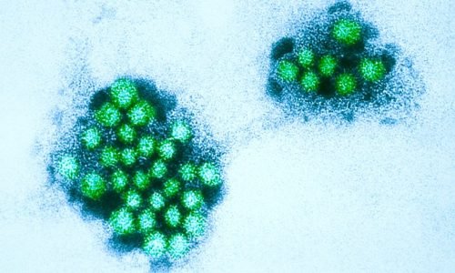 Alerta de Norovírus em Boston: Escolas Reforçam Protocolos de Higiene Após Surto em Massa