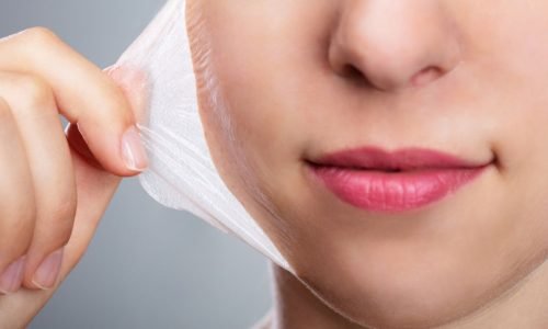 A Temporada da Renovação: Como os Peelings Químicos Transformam a Sua Pele